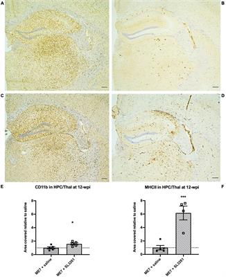 Systemic Inflammation Accelerates Changes in Microglial and Synaptic Markers in an Experimental Model of Chronic Neurodegeneration